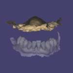 La protesi full digitale 4.0 Protesi full digitale