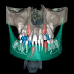 Intelligenza artificiale e Ortodonzia: la giusta sinergia fra tecnologie hi-tech e clinica Ortodonzia Intelligenza Artificiale