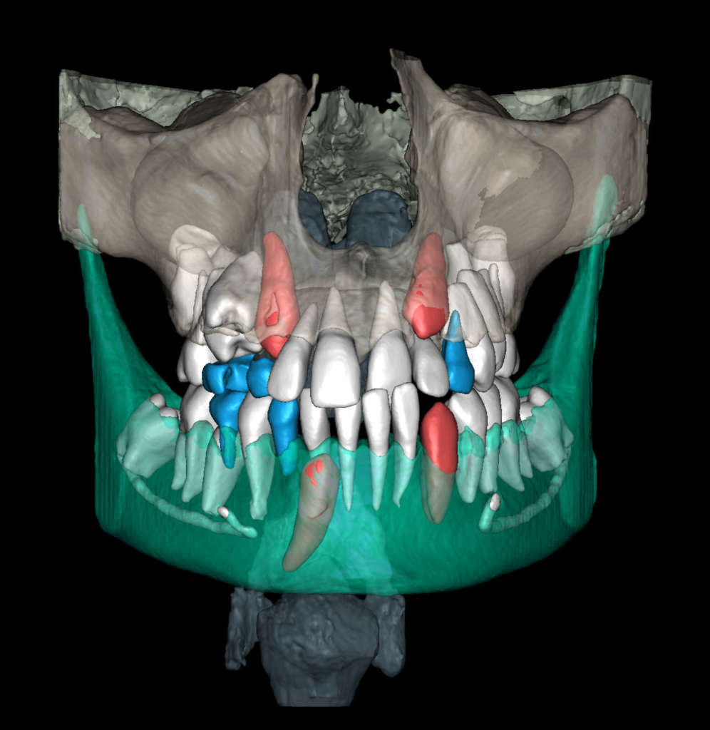 Ortodonzia Intelligenza Artificiale