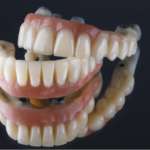 Edentulie, protesi e benessere dei pazienti Edentulie protesi