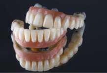 Edentulie, protesi e benessere dei pazienti Edentulie protesi