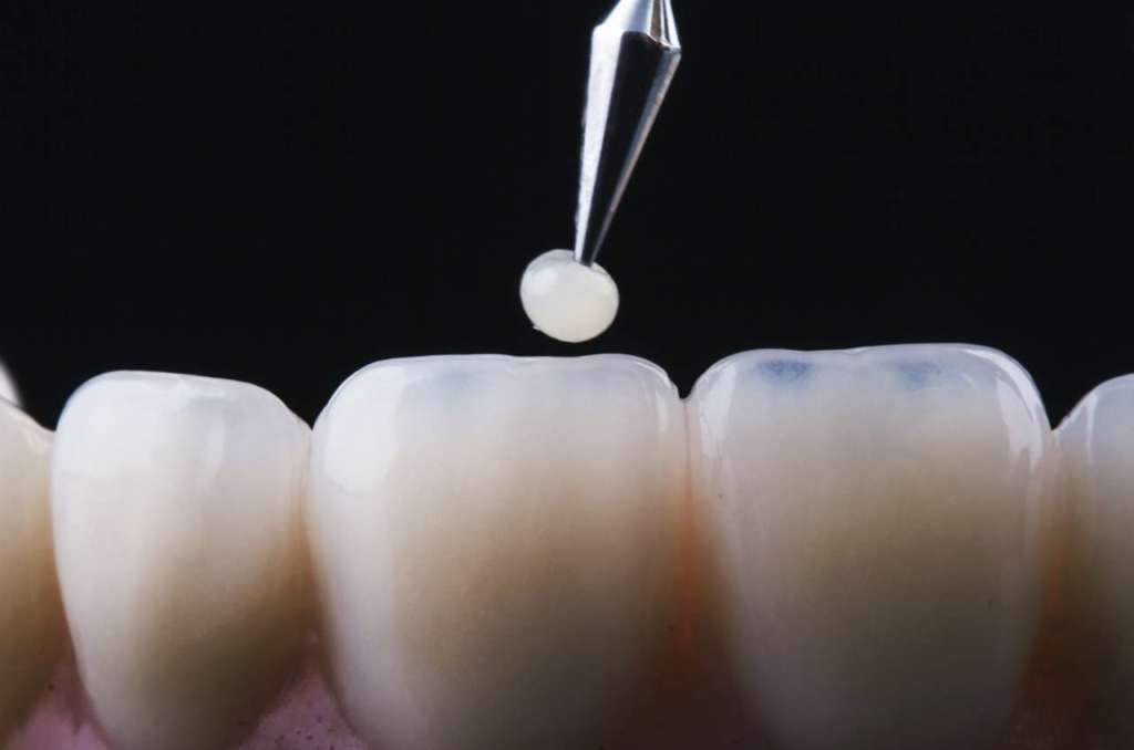 IA Odontoiatria conservativa