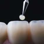 L’odontoiatria restaurativa si prepara al futuro IA Odontoiatria conservativa