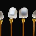 Faccette dentali: i fattori di successo studiati in laboratorio faccette dentali