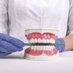 Malocclusione di II classe: qual è il trattamento ideale malocclusione di II classe