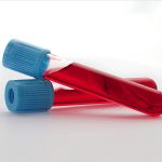 Fibrina ricca di piastrine, crescono le applicazioni anche in odontoiatria