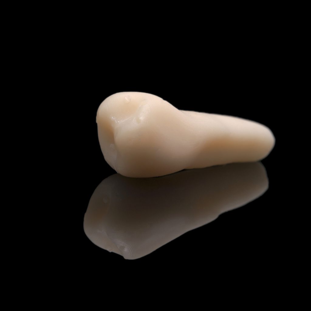 Autotrapianto dentale PRGF-Endoret