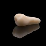 Tecnica di autotrapianto step by step e utilizzo di PRGF-Endoret per risolvere un trauma dentale Autotrapianto dentale PRGF-Endoret