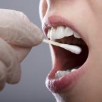 La saliva acida e altre storie