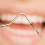 Con l’alendronato topico la chirurgia parodontale è più efficace Terapia parodontale di supporto