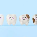 Placca e carie: nuovi studi sui peptidi antimicrobici