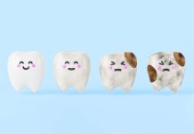 Placca e carie: nuovi studi sui peptidi antimicrobici