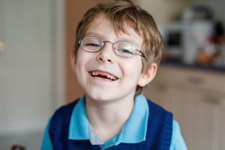 L’autotrapianto dentale in un paziente pediatrico