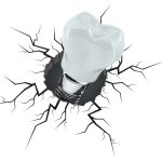 Frattura degli impianti: fattori di rischio e prevenzione Frattura impianti