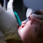 Parodontite, depressione e ansia studiate su un ampio campione parodontite, depressione e ansia