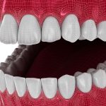 Protesi totali digitali, da uno studio le linee guida per realizzarle al meglio Protesi totali digitali