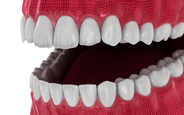 Protesi totali digitali, da uno studio le linee guida per realizzarle al meglio