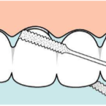 Igiene orale: nuovo TePe Bridge & Implant Floss TePe