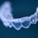 Gli aligner rispettano il microbioma orale più degli apparecchi fissi allineatori trasparenti