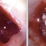 Utilizzo multidisciplinare del Surgiplaster Surgiplaster