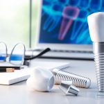 Implantologia in continua evoluzione impianti dentali