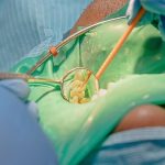 Lesioni endo-parodontali: nuove prospettive per una gestione conservativa Lesioni endo-parodontali