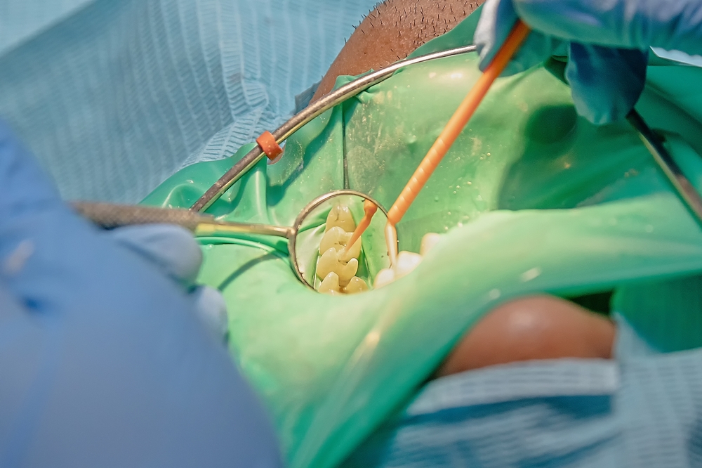 Lesioni endo-parodontali