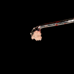 Il dente come materiale da innesto. Un caso clinico