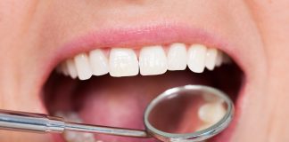 Nella lucidatura del composito, la pressione conta più dell’ingrandimento Lucidatura del composito