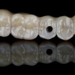 La zirconia stampata in 3D: nuove frontiere per la protesi odontoiatrica Zirconia stampa 3D