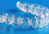 Allineatori trasparenti: un nuovo consenso internazionale Allineatori consenso internazionale