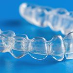 Allineatori trasparenti: un nuovo consenso internazionale Allineatori consenso internazionale
