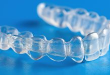 Allineatori trasparenti: un nuovo consenso internazionale Allineatori consenso internazionale