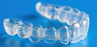 Allineatori trasparenti: un nuovo consenso internazionale Allineatori consenso internazionale