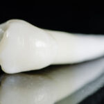 Carie radicolare: l’efficacia di alcuni agenti remineralizzanti in uno studio in vitro Carie radicolare