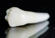 Carie radicolare: l’efficacia di alcuni agenti remineralizzanti in uno studio in vitro Carie radicolare