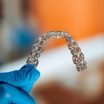 Un nuovo rivestimento antibatterico per “retainer trasparenti” rivestimento antibatterico