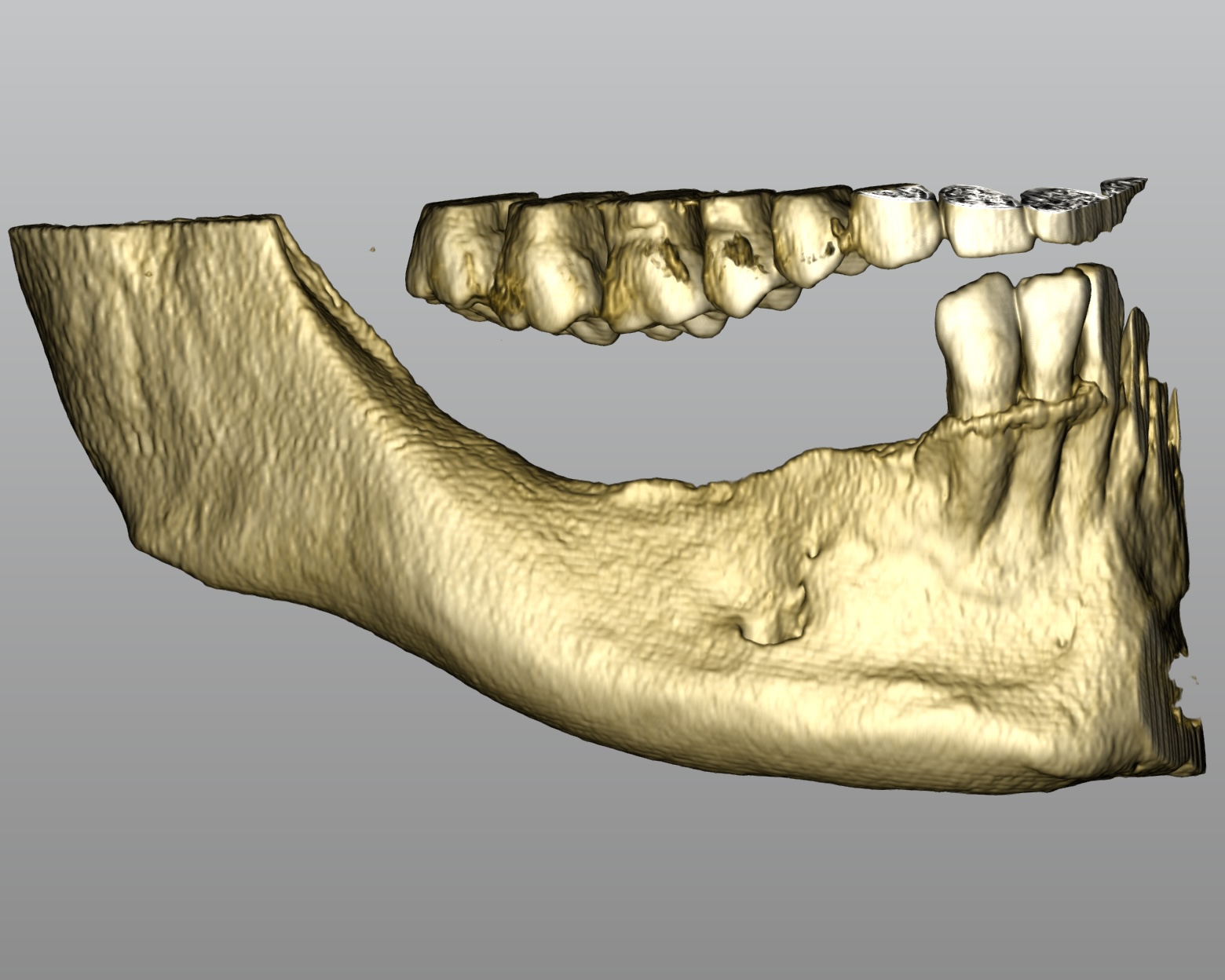 GBR griglia customizzata