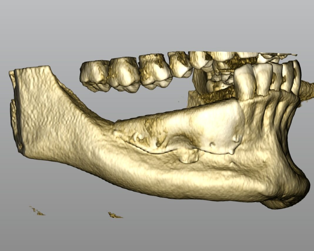 GBR griglia customizzata