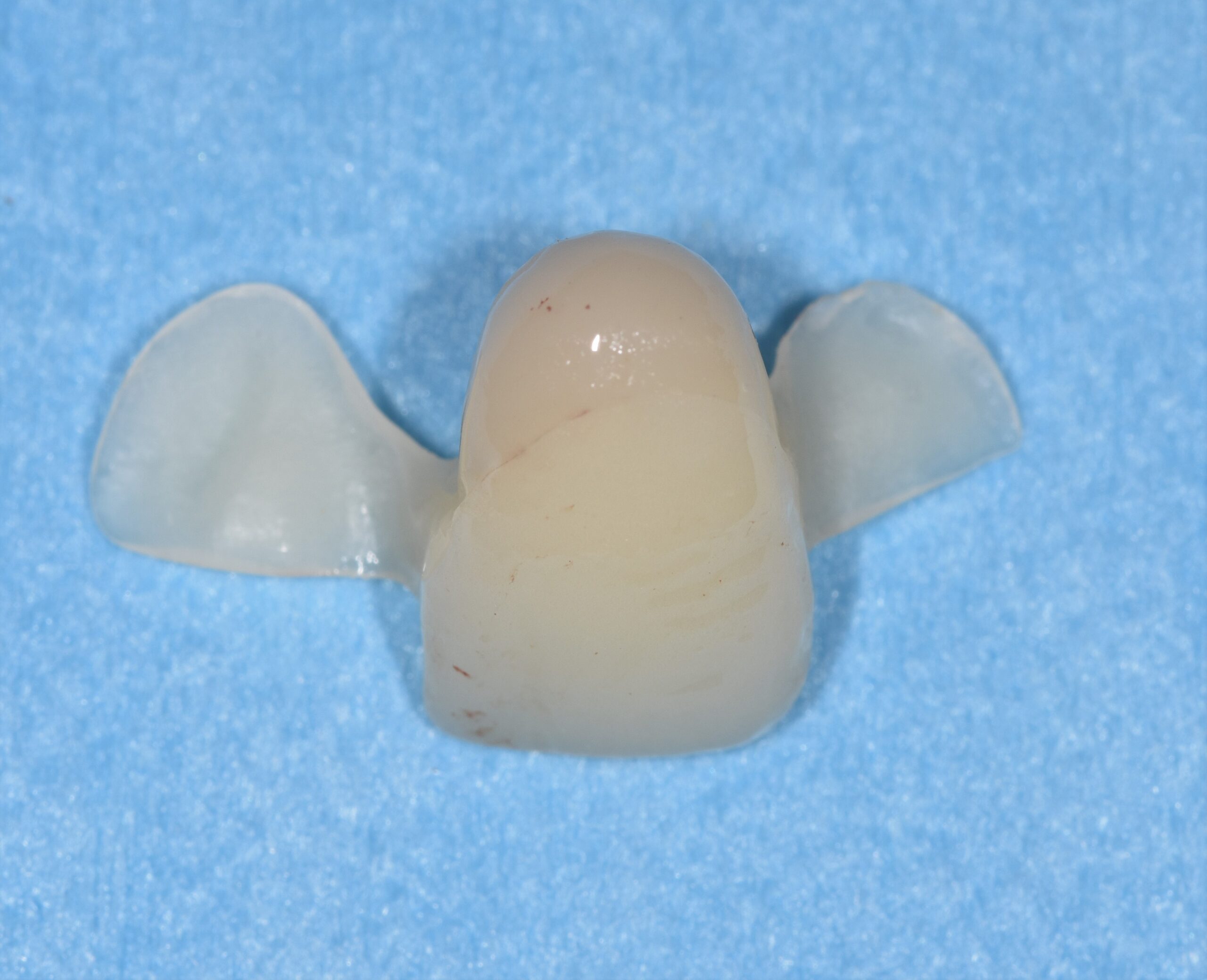 profilo tissutale impianto post-estrattivo