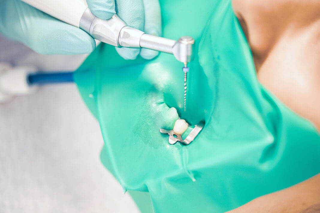 Micromotori endodontici