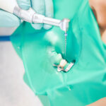 Micromotori endodontici smart Micromotori endodontici