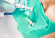 Micromotori endodontici smart Micromotori endodontici