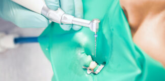 Micromotori endodontici smart Micromotori endodontici