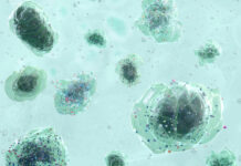 Microplastiche, un problema anche per lo studio odontoiatrico Microplastiche