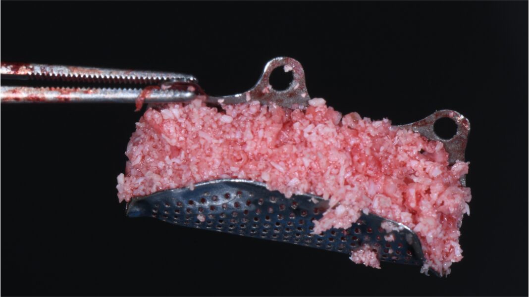 mesh in titanio