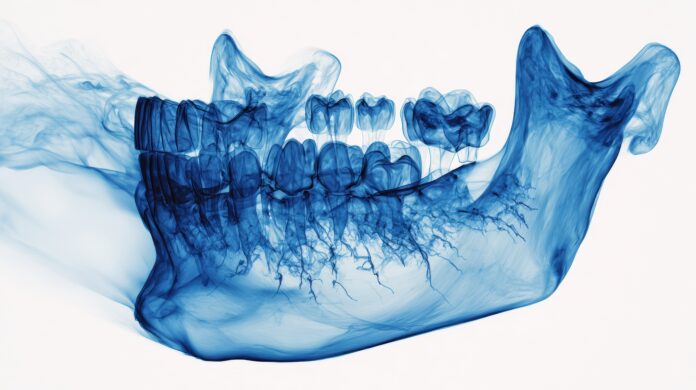 osteoporosi
