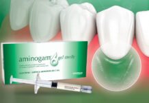 Una nuova siringa sterile per la terapia rigenerativa orale: Aminogam® 6 con acido ialuronico e 6 aminoacidi