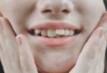 Affollamento dentale: sintomi e trattamenti per migliorare la qualità di vita dei pazienti Affollamento dentale