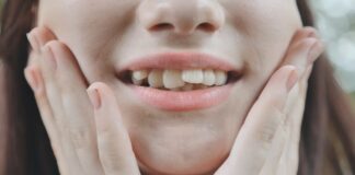 Affollamento dentale: sintomi e trattamenti per migliorare la qualità di vita dei pazienti Affollamento dentale